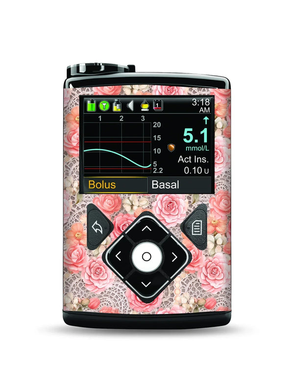 Medtronic MiniMed with Summer Edition stickers in vibrant tropical designs.