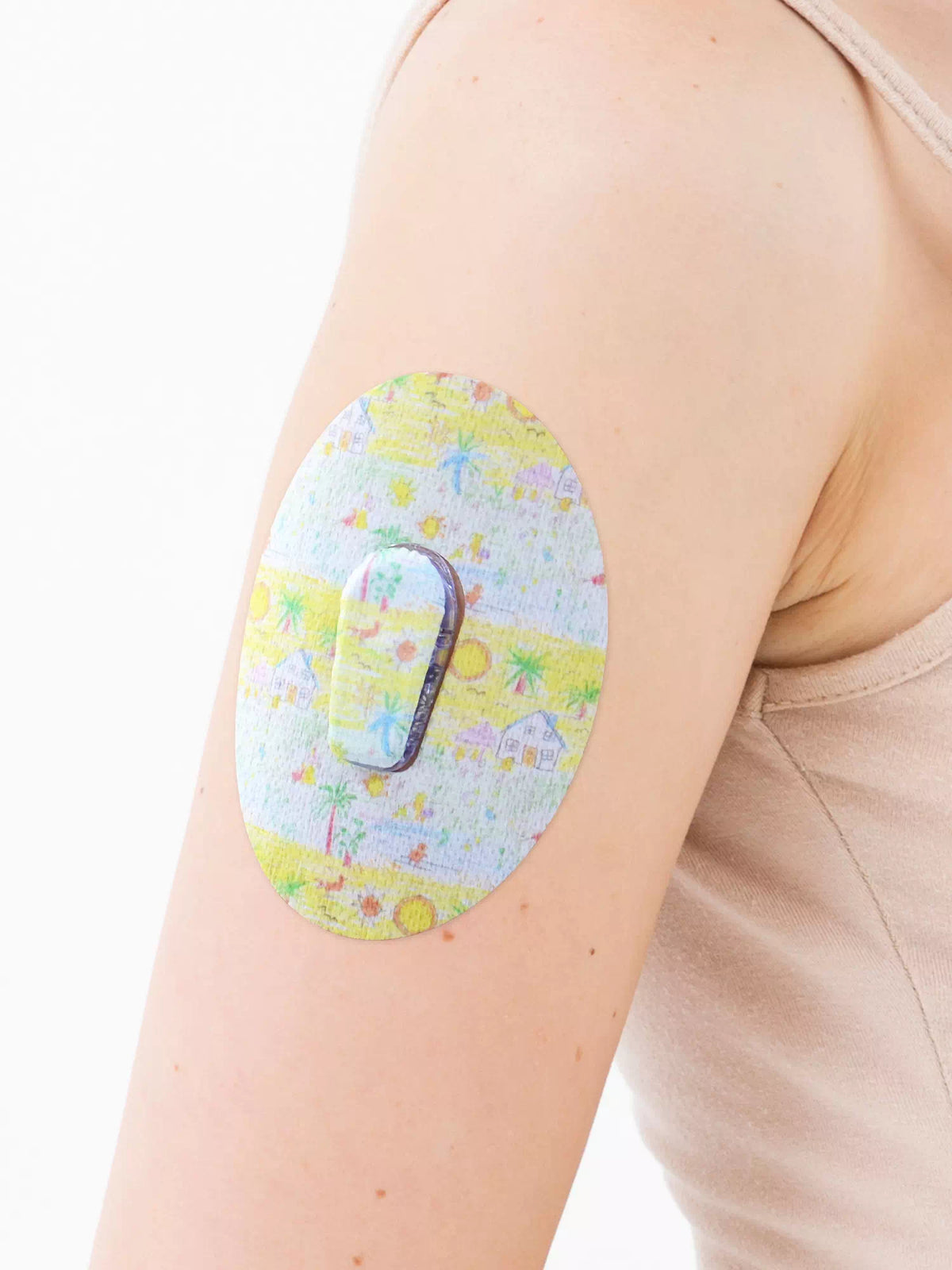Plaster til Dexcom G6, design Childhood Memories, på armen