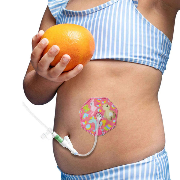 Beskyttelsespuder til gastrostomi til børn – Søde farverige mønstre & blød komfort | Kaio-Tube Pads