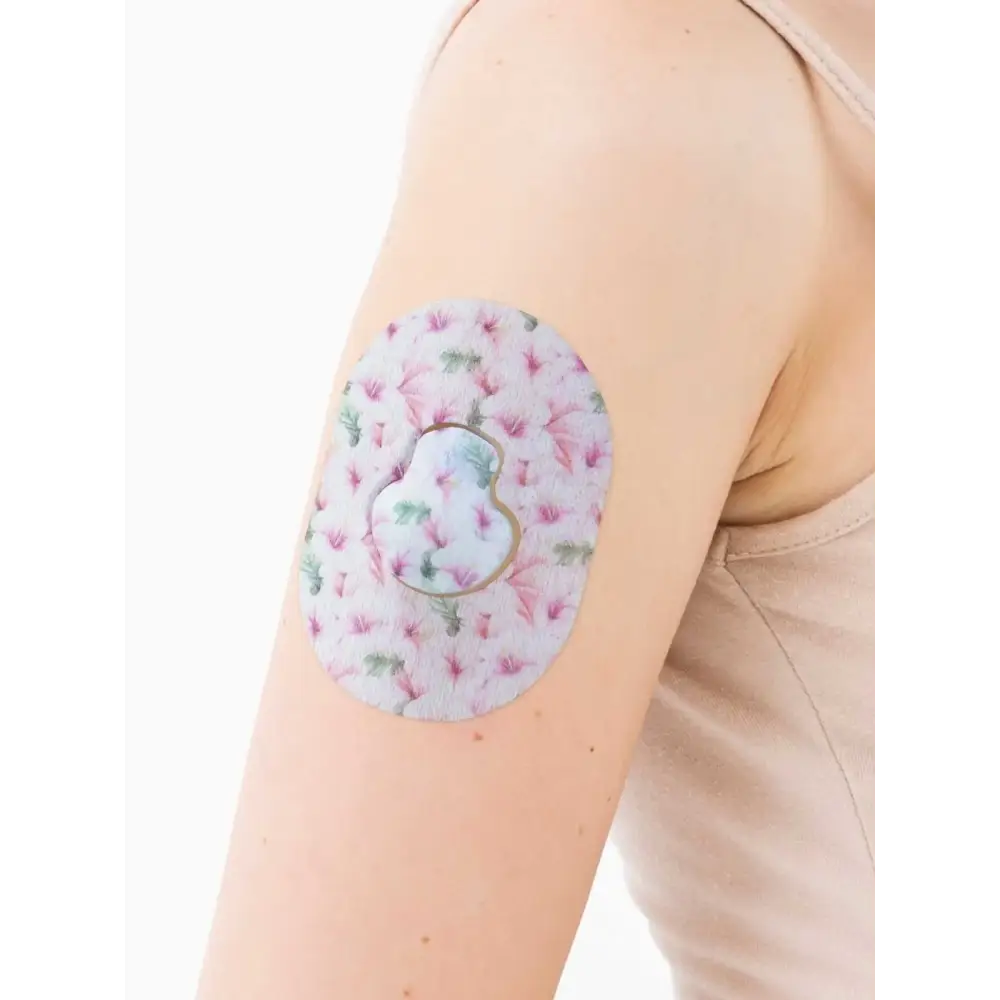Plaster til Medtronic Guardian, Spring-serien, på armen, nærbillede